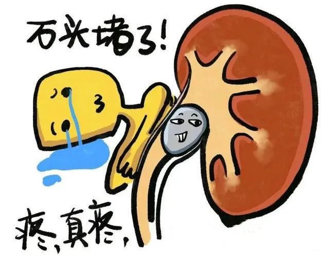 别让万物复苏的时节,成为尿路结石的"春天"!
