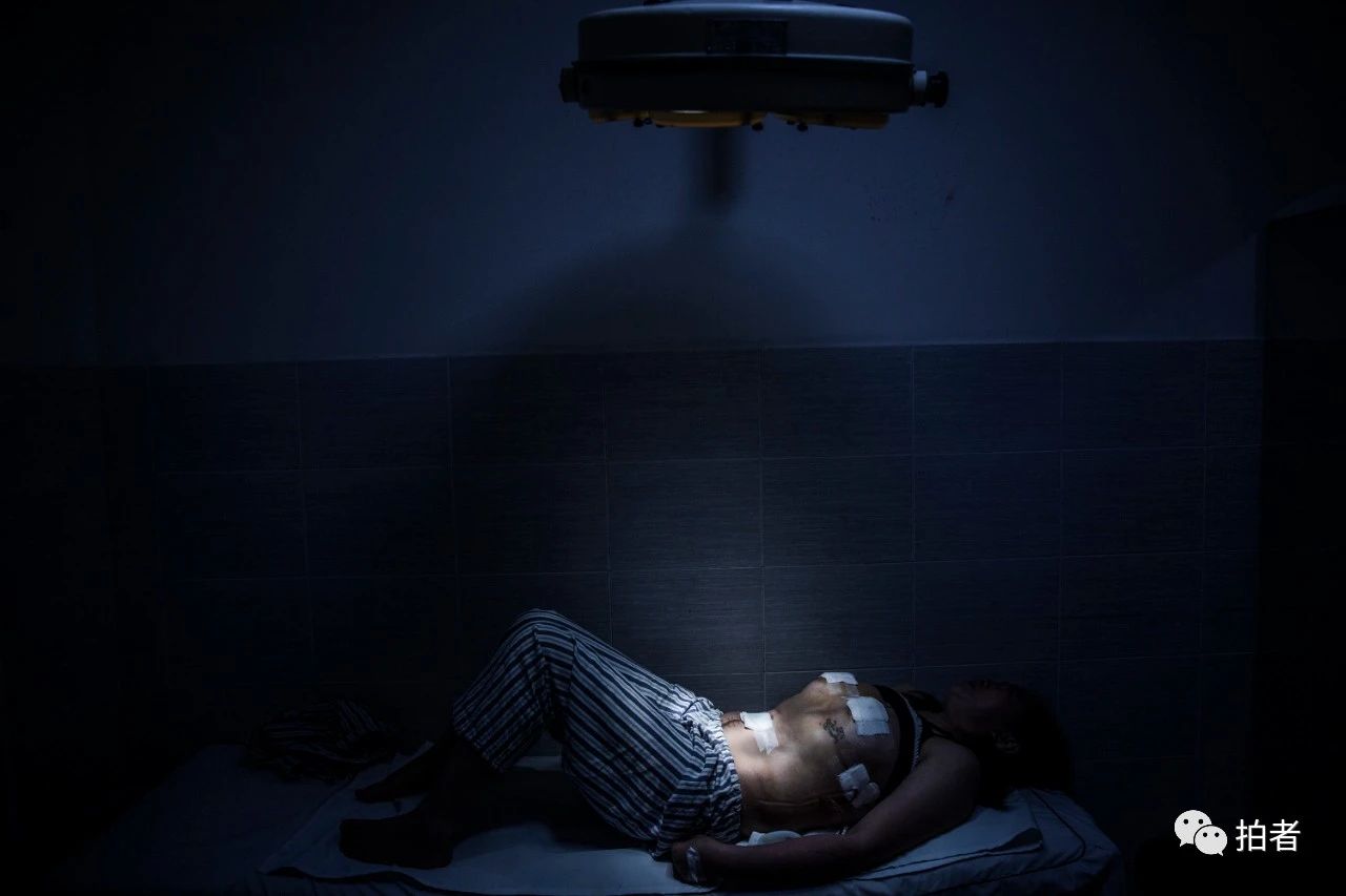 读盘|我用七年时间,记录上百个整容者的故事