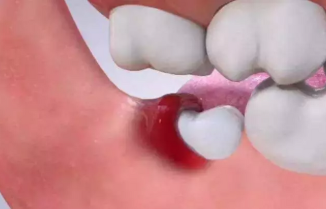 《智齿》免费完整观看(完整/加长版)【1080p高清熟肉】中字已更新