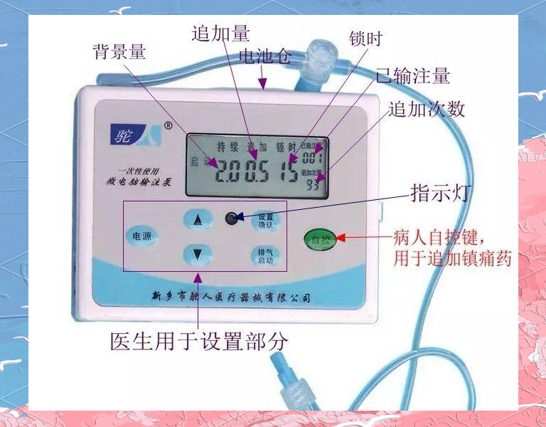 如何正确使用镇痛泵?掌握这些技巧,让镇痛效果更佳