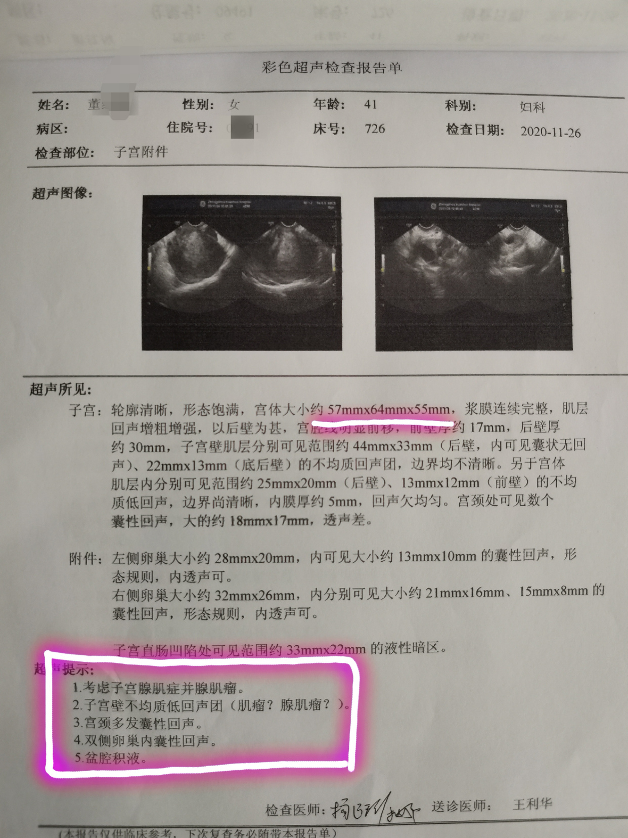 「四川内江」建议海扶刀或曼月乐环,她都没同意