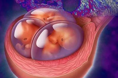 试管移植第三天胚胎图图片