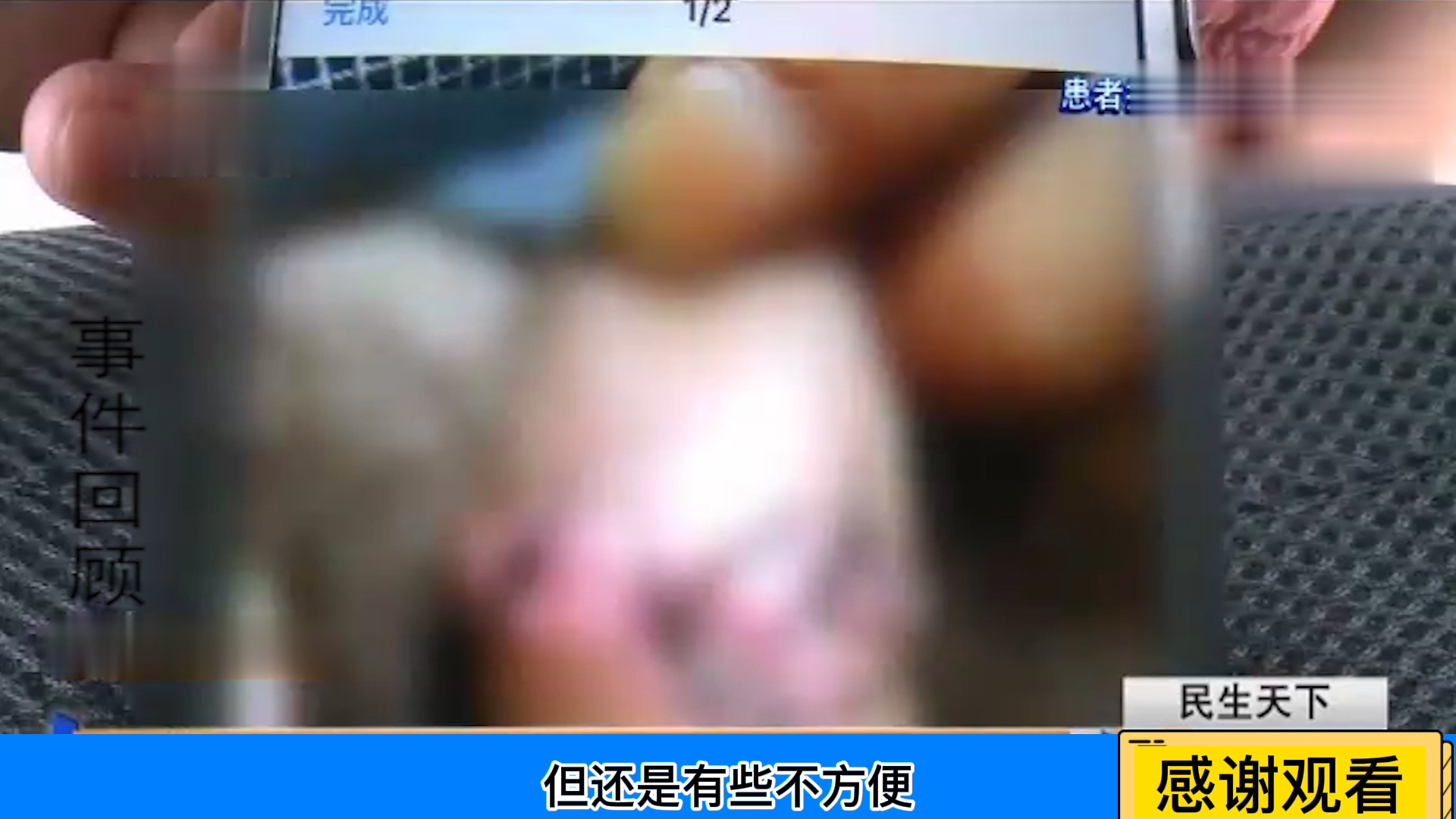 真扯"蛋"!男子上厕所裤子拉链卡住"命根子",几天都不去救治