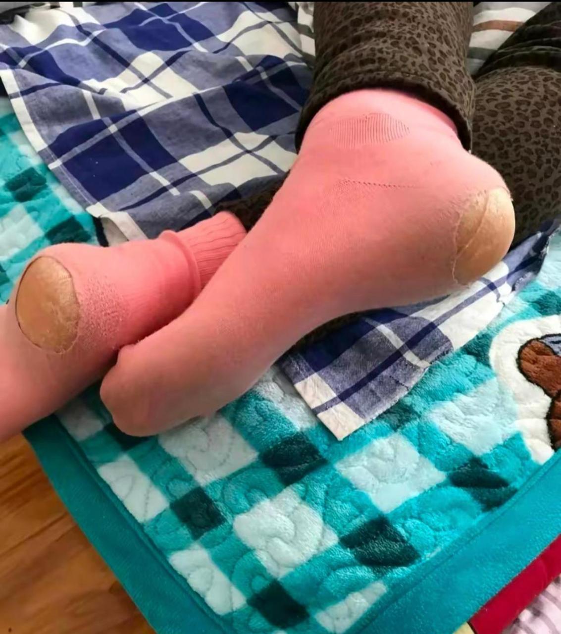 袜子脚后跟老是破个洞,不知道是袜的问题还是脚的问题.