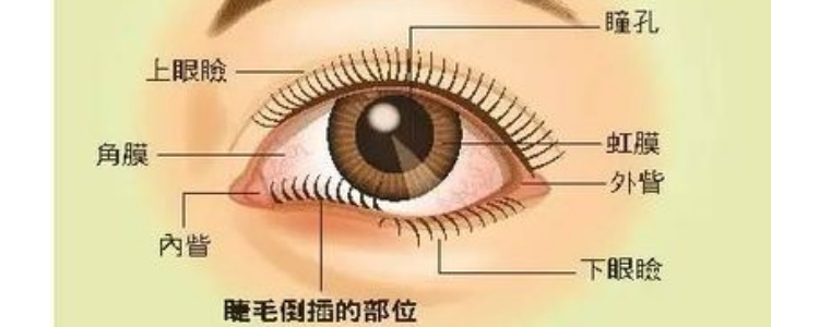 倒睫毛小妙招?