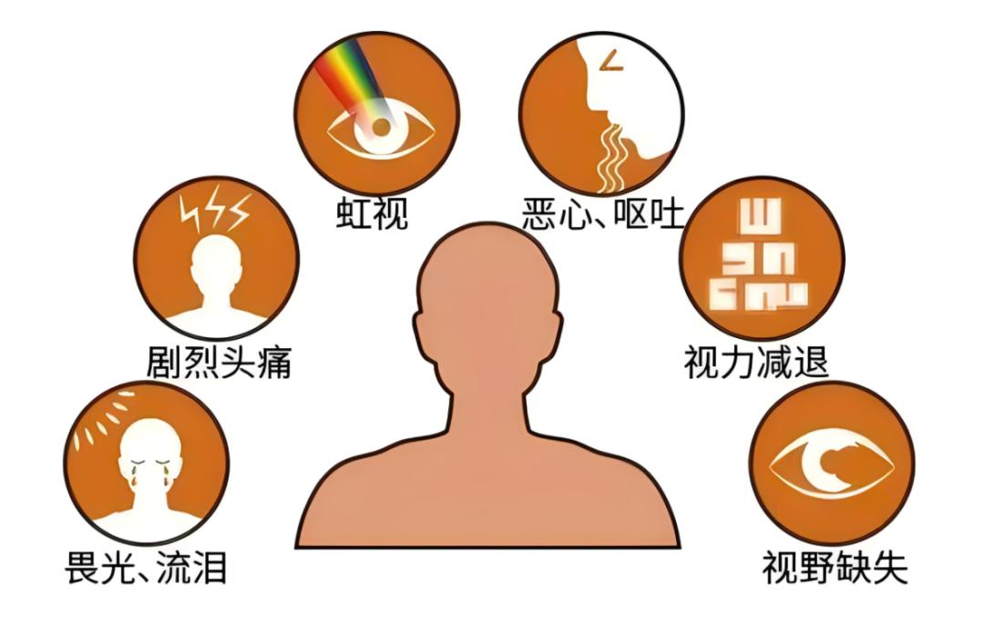 闵小卫说健康丨青光眼——无声的视力"盗贼"