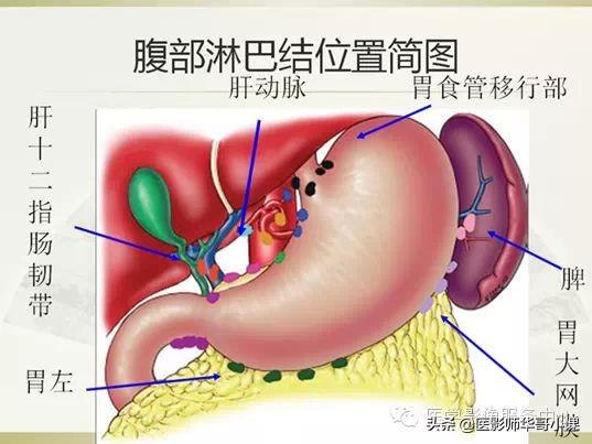 「淋巴结分布」腹部淋巴结分部