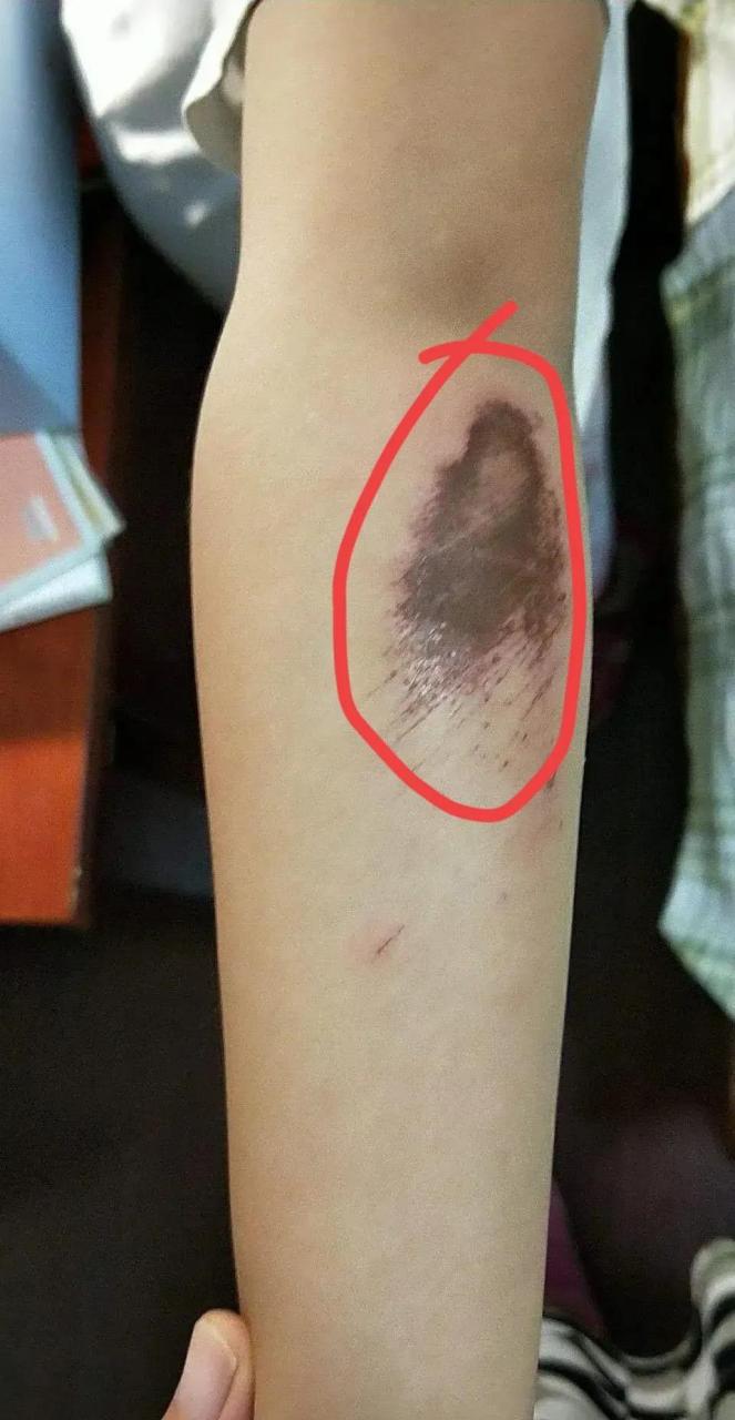 近日,一女子实名举报山西某中学男教师王志慧性侵,家暴,参与多人运动