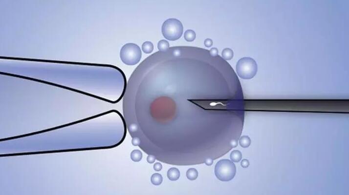 什么是试管婴儿胚胎植入前基因检测?有风险吗?什么人适合做?