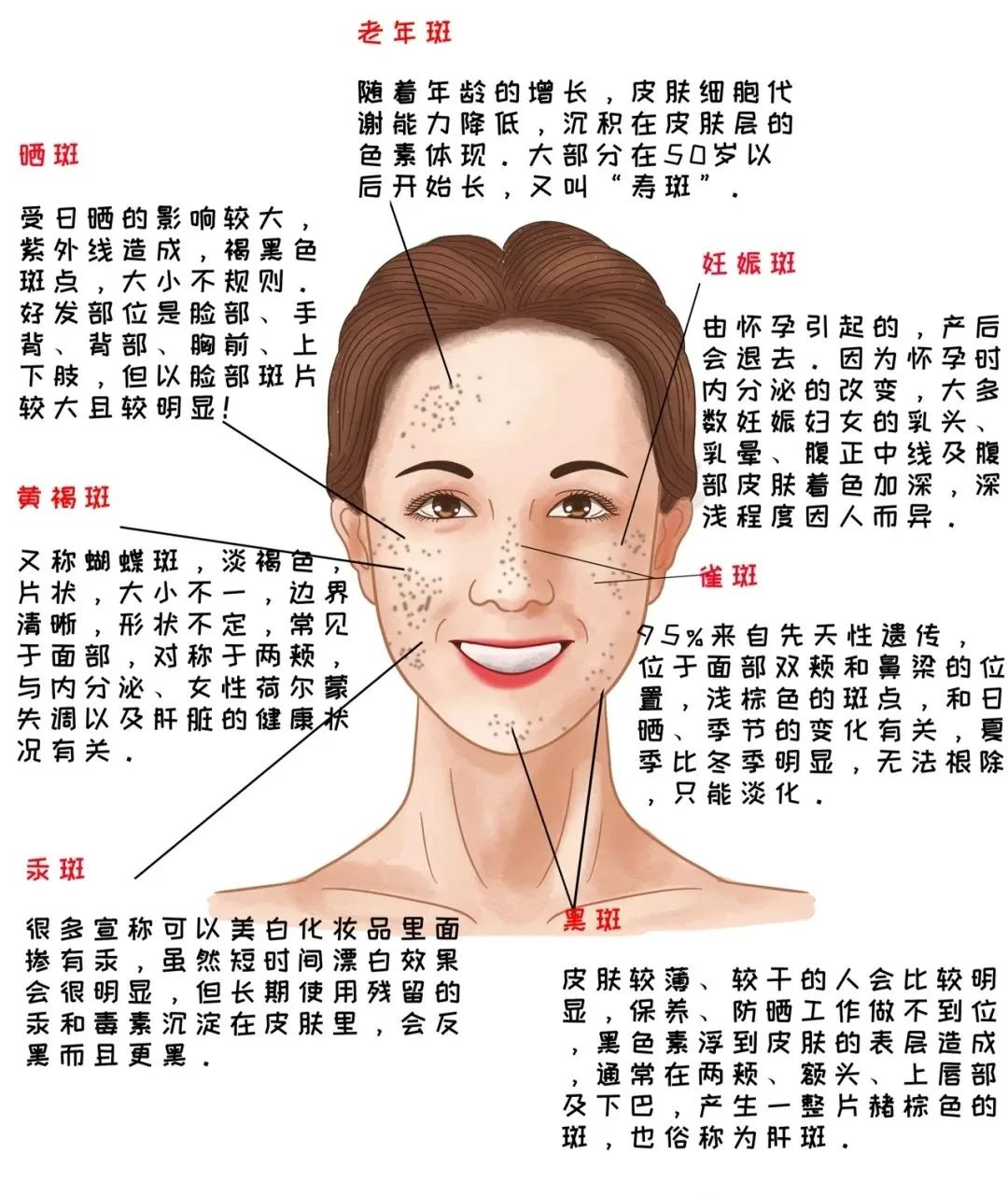 面部常见的色素斑类型和预防