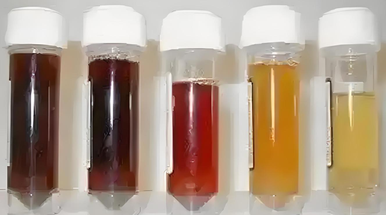尿液颜色暗藏的健康信号及其背后隐忧