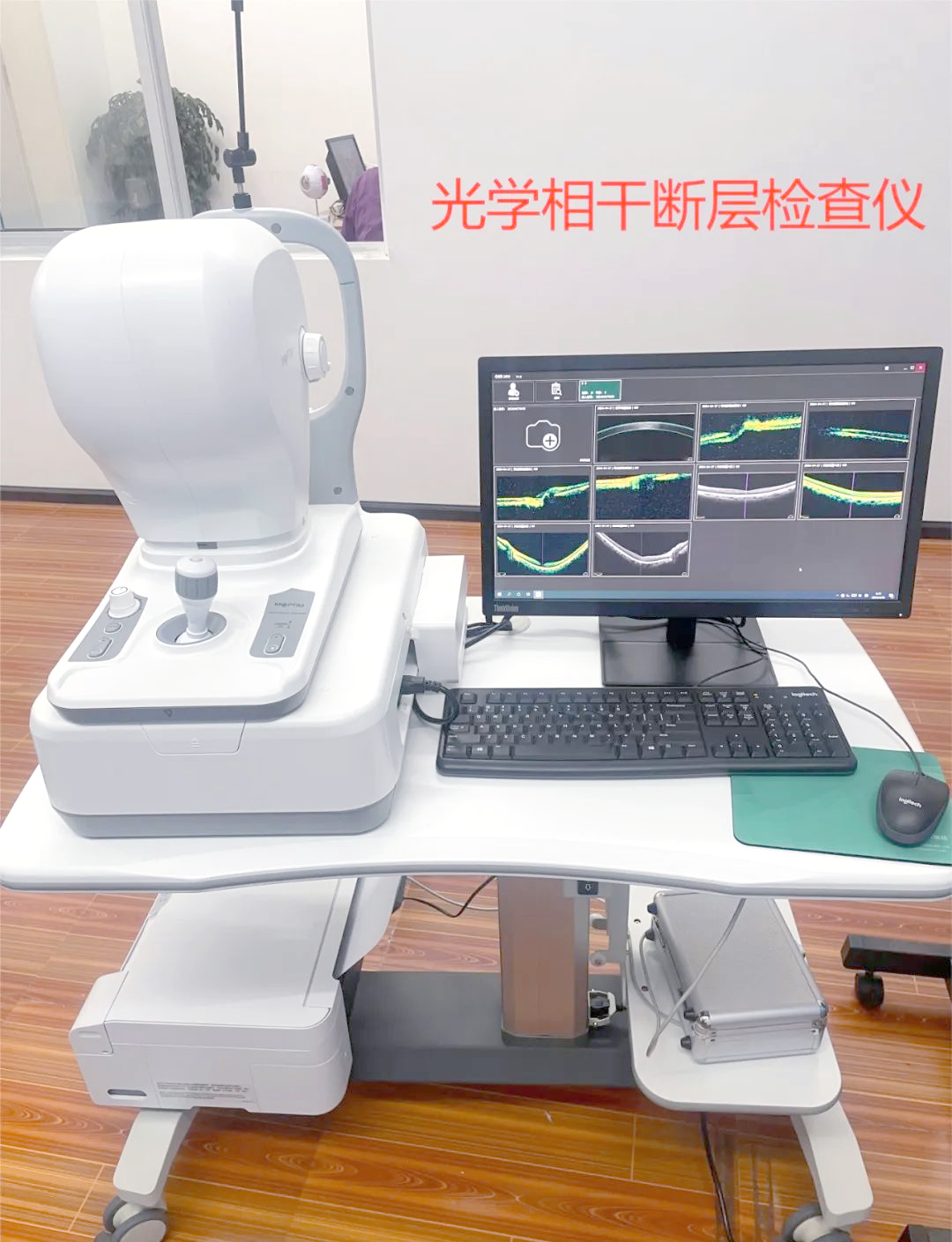 眼科oct检查一种非侵入性的眼科诊断技术