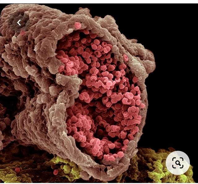 电子显微镜下的人体组织,很美的,你看过几个