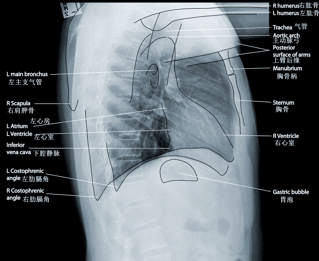 ①在观察完胸片后,我们转向膈肌以下的部分,即上腹部.5.