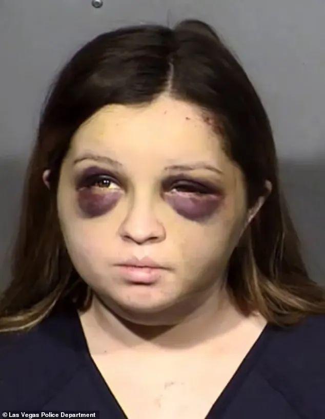 美国一女子把自己打成熊猫眼,被警察逮捕了