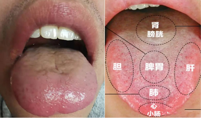 观舌看病图解病情图片