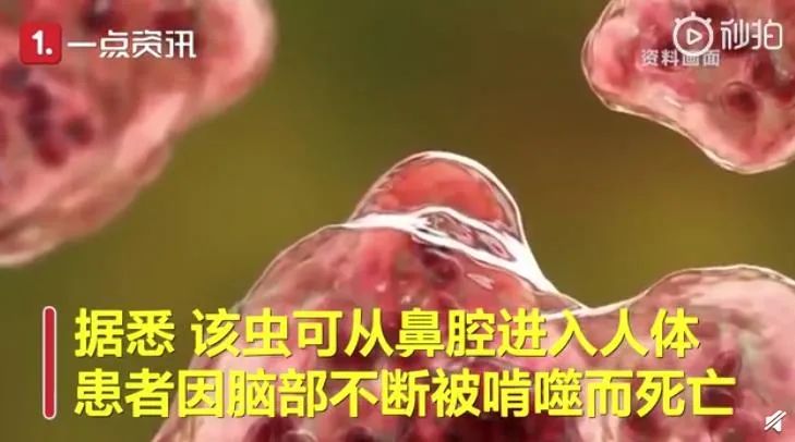 美国再现食脑虫感染病例:从鼻腔进入啃噬人脑