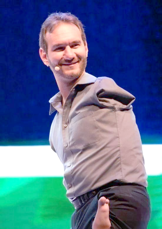 尼克胡哲:无四肢者的精彩人生与积极影响