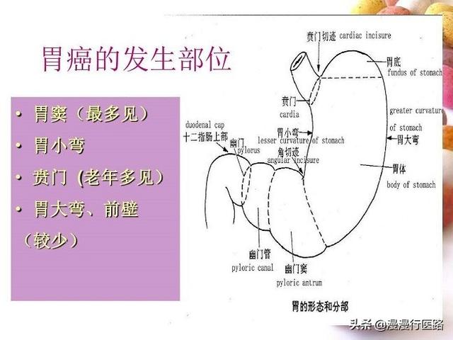 胃癌四大發病機制你瞭解多少呢?一文帶你瞭解!先從預防做起