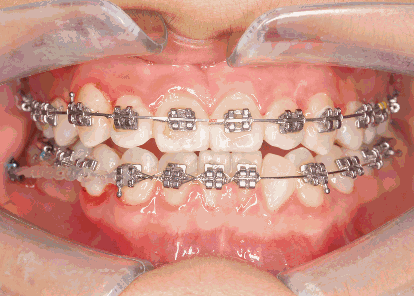 414_296gif 动态图 动图