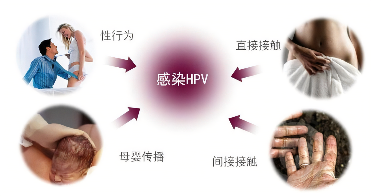 hpv到底是什么,姐妹们都那么怕?