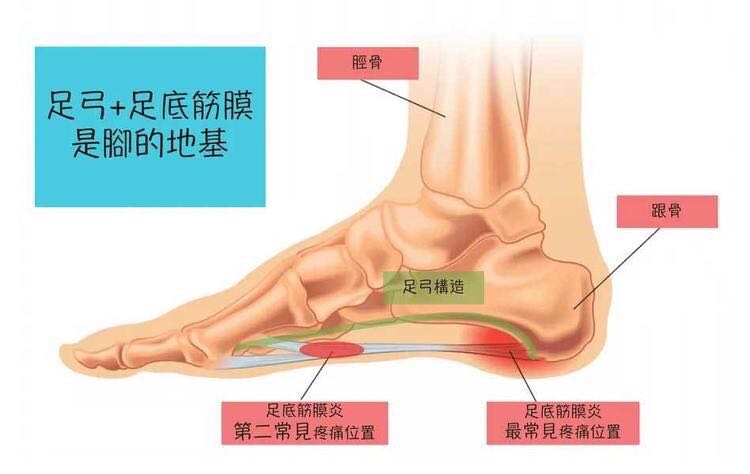 脚底疼痛挂什么科图片