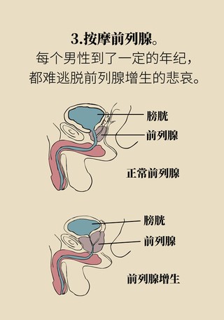 有效预防痔疮,按摩前列腺,锻炼盆底肌……这项运动虽小,好处不少