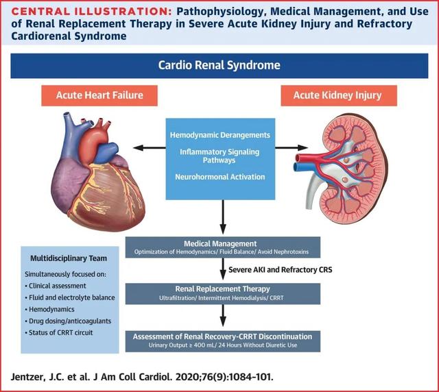 jacc:严重急性肾损伤和难治性心肾综合征的管理,十大要点全掌握