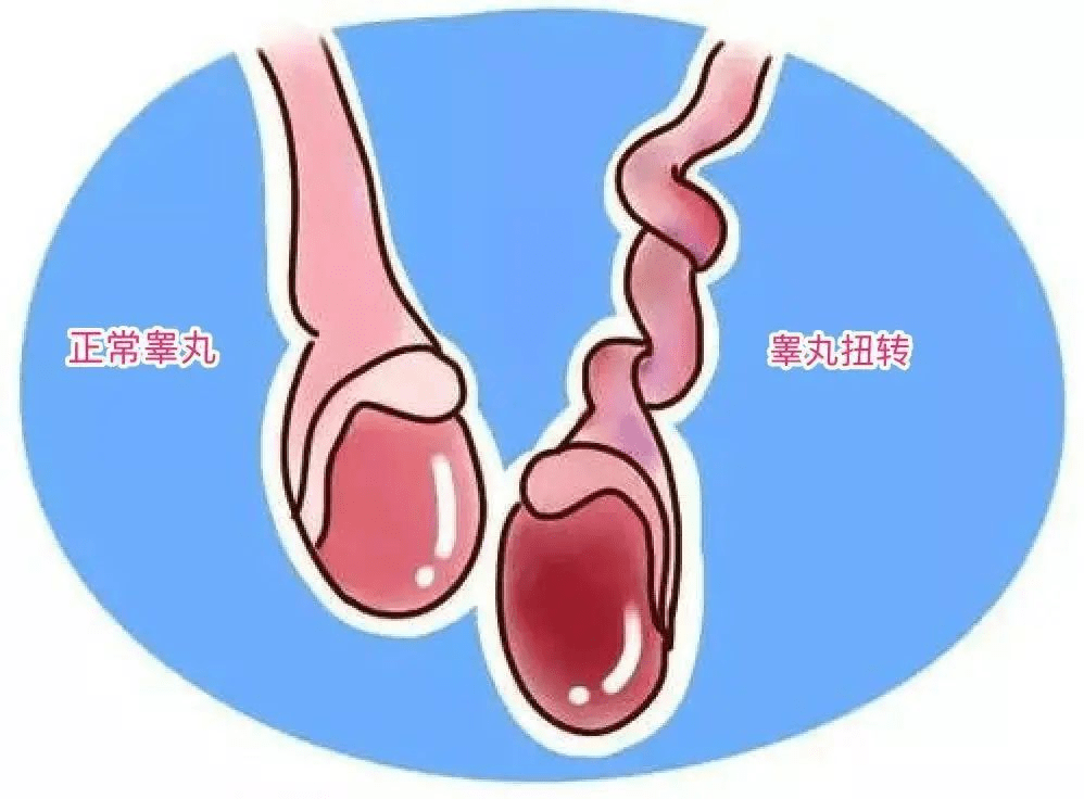 睾丸疼痛是怎么了?塘沽男科医院