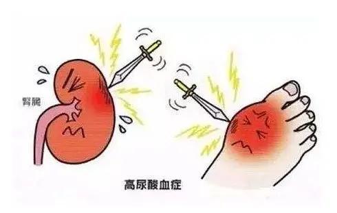 尿酸高怎么降下来,降尿酸的最佳方法