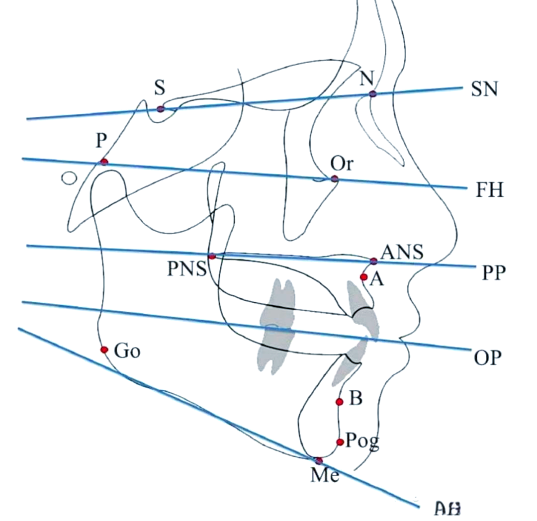 头影测量中如何准确找到标记点
