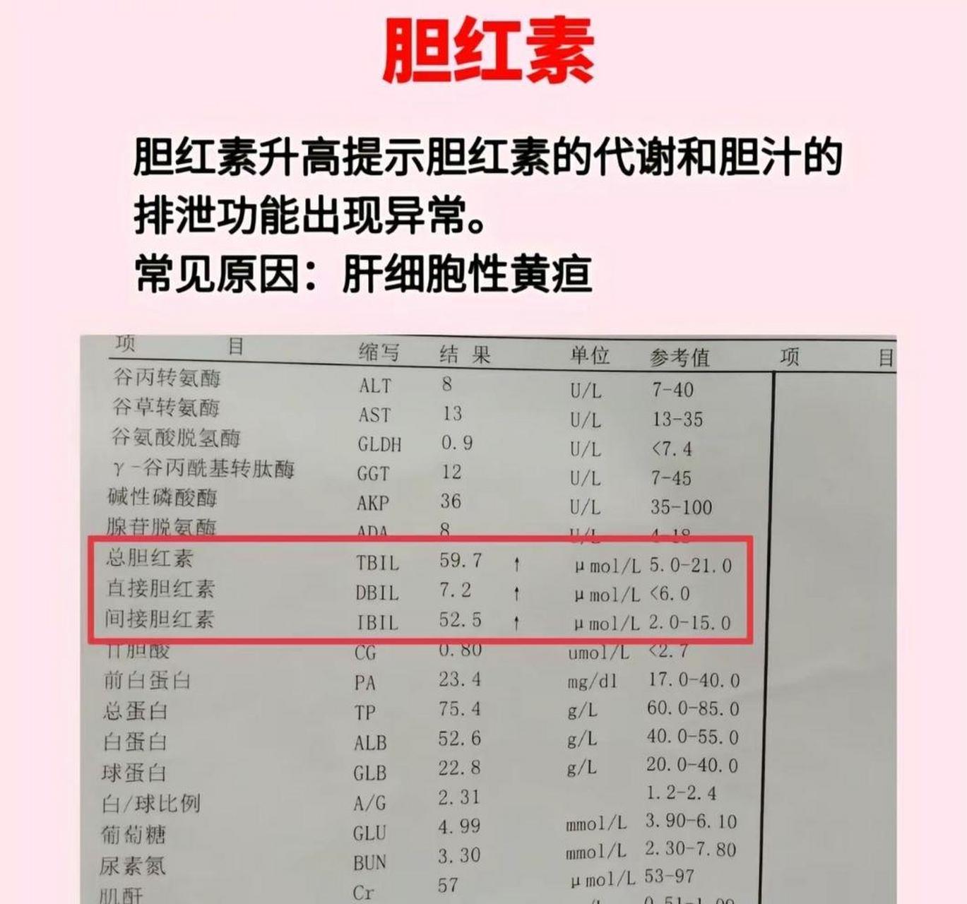 肝功能解读——胆红素系列  1,直接胆红素和间接胆红素升高 常见于肝