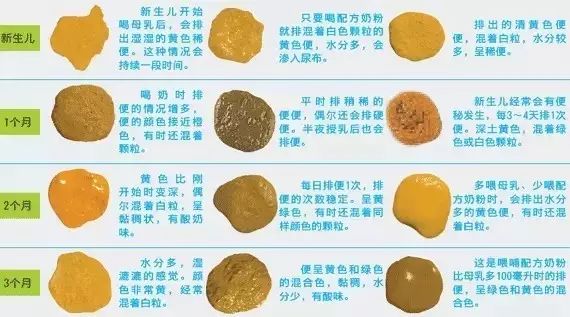 宝宝大便发白?出现这些颜色要警惕