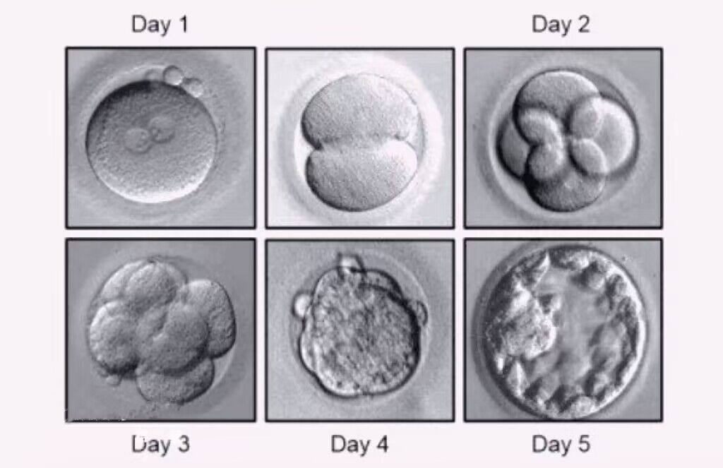 一级八细胞胚胎照片图片