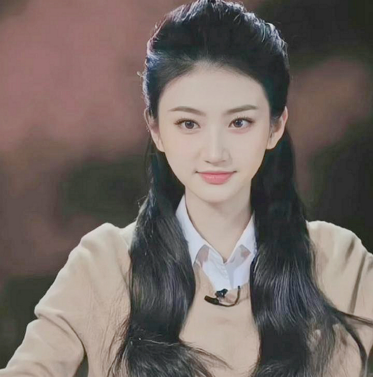 景甜现在恢复不错,但有一段时间双眼皮宽到看不见