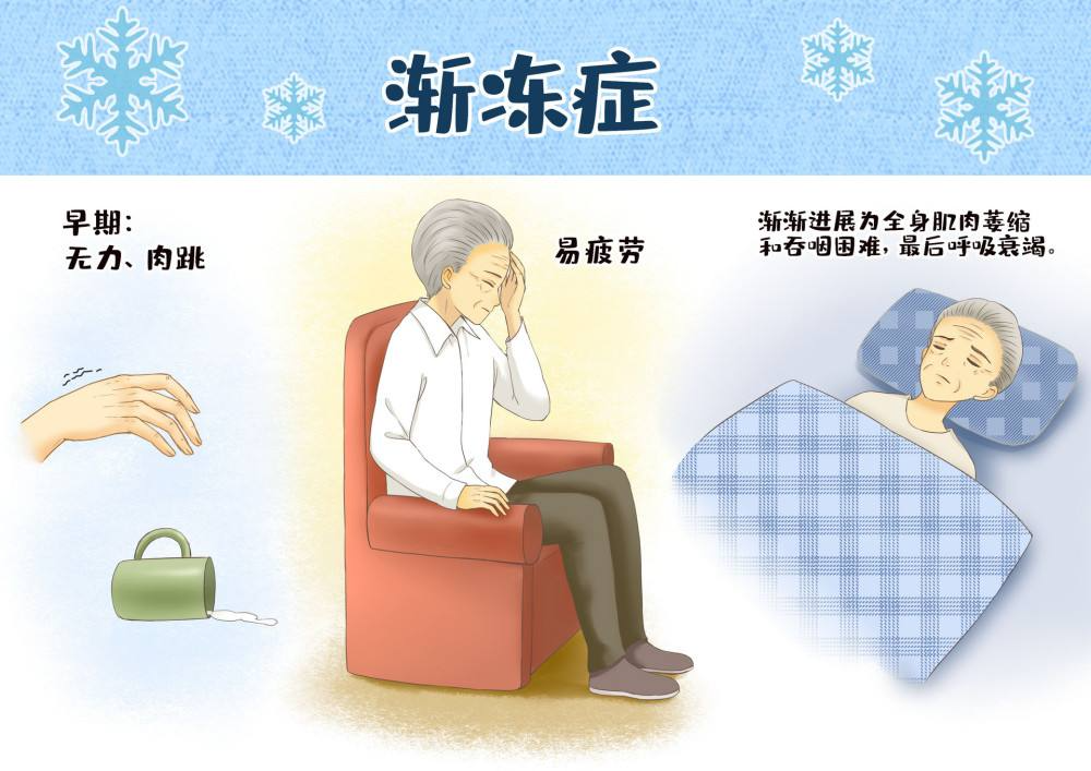 最新电影王祖蓝饰演渐冻症患者,预防渐冻症,这些健康方式很重要