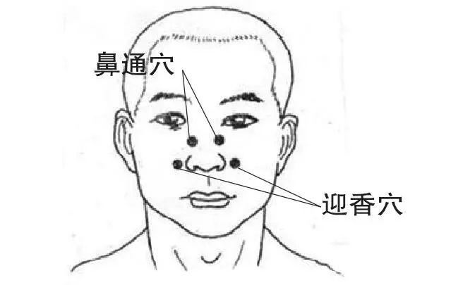 鼻炎别不当回事!中医教你几招,效果特别好