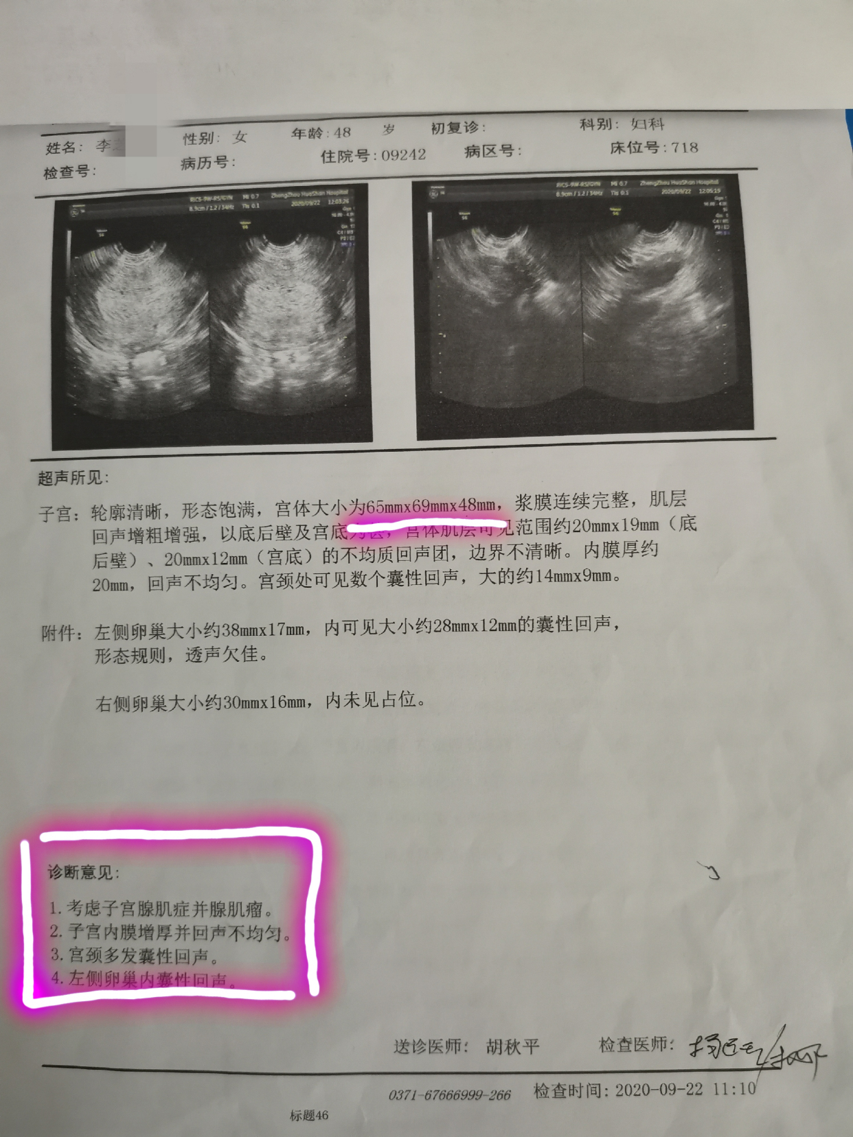 子宫增大,子宫内膜增厚,拒绝诊刮,为求保宫治疗至我院就诊