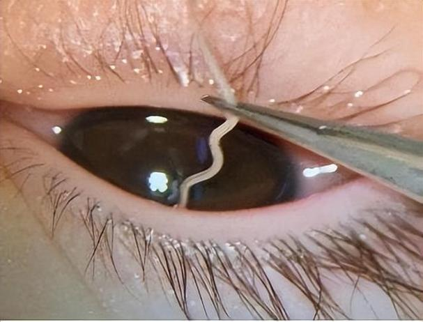 家庭宠物引发的眼睛寄生虫感染:专家解读与预防建议