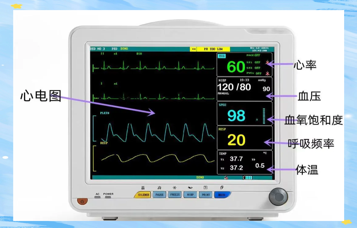 心电监护仪的健康科普指南