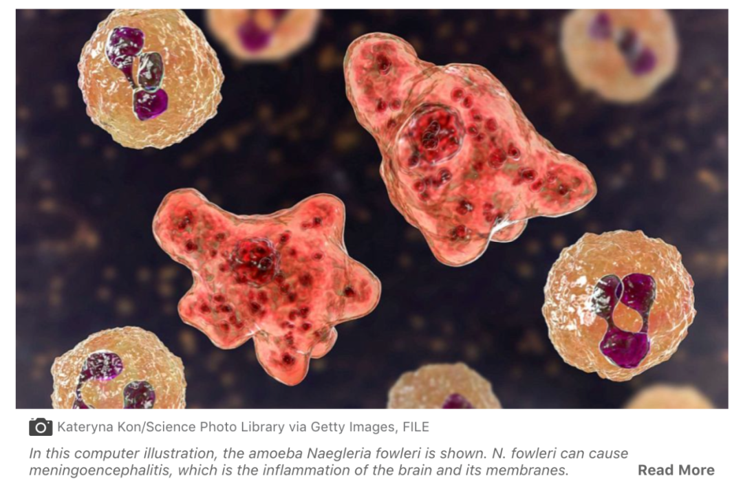 美国再现"食脑虫",得州十余地区被禁止使用水源