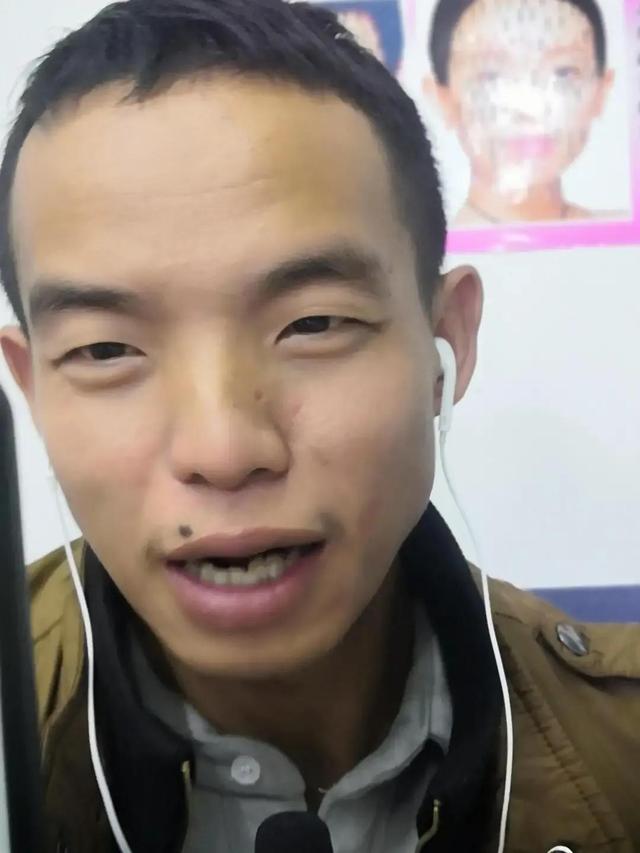 世界上最恶心的人 盘点世界上最丑最恶心的人