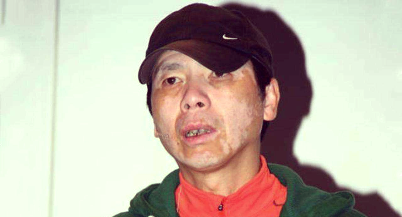 白癜风早期症状