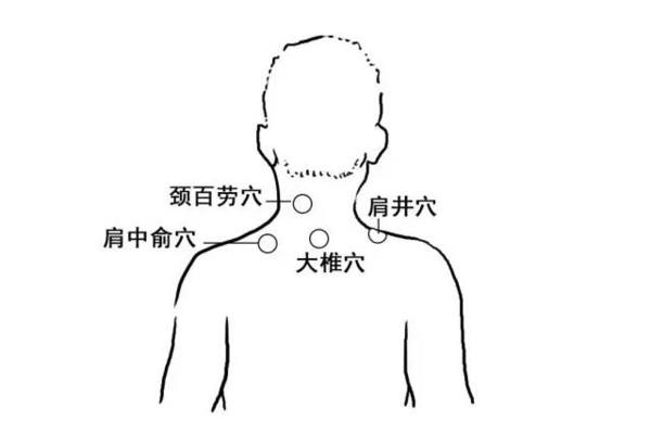 「康复理疗」中医颈椎24小时保养法