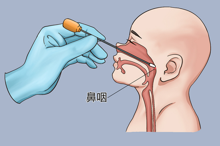 鼻拭子要戳多深图片