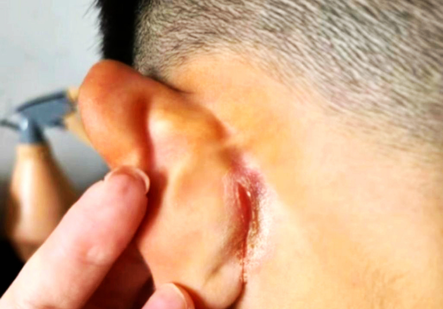 孩子在学校不听话,耳朵扭成这样