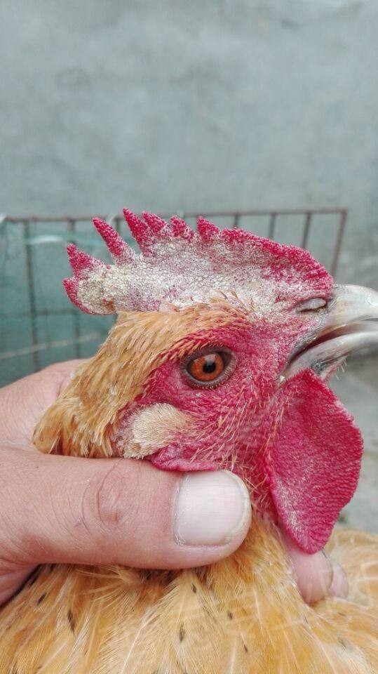 鸡冠长癣用什么 鸡冠癣怎么治疗