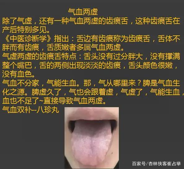 气血两虚 baijiahao.baidu.com