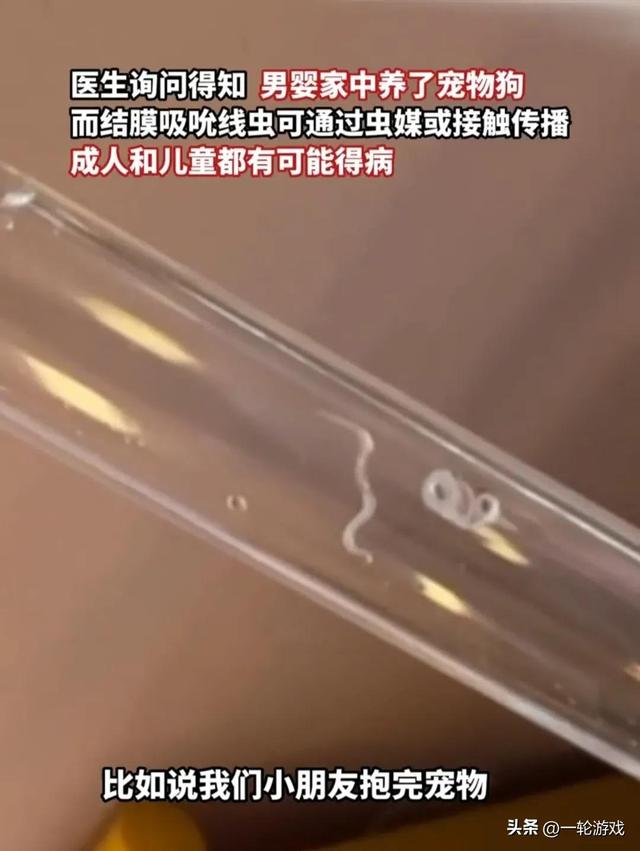 8個月大的孩子眼睛裡取出寄生蟲