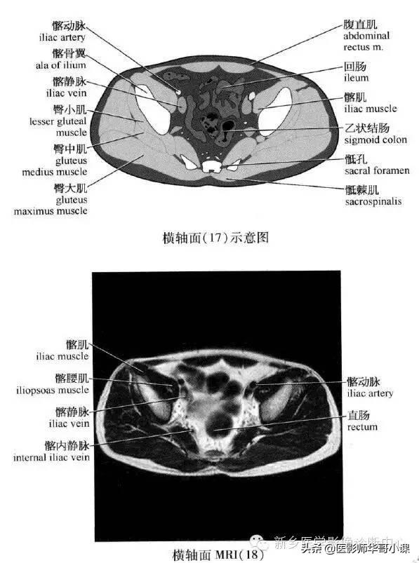 「腹部ct断层解剖」腹部ct扫描横断位解剖 详细标注,值得收藏